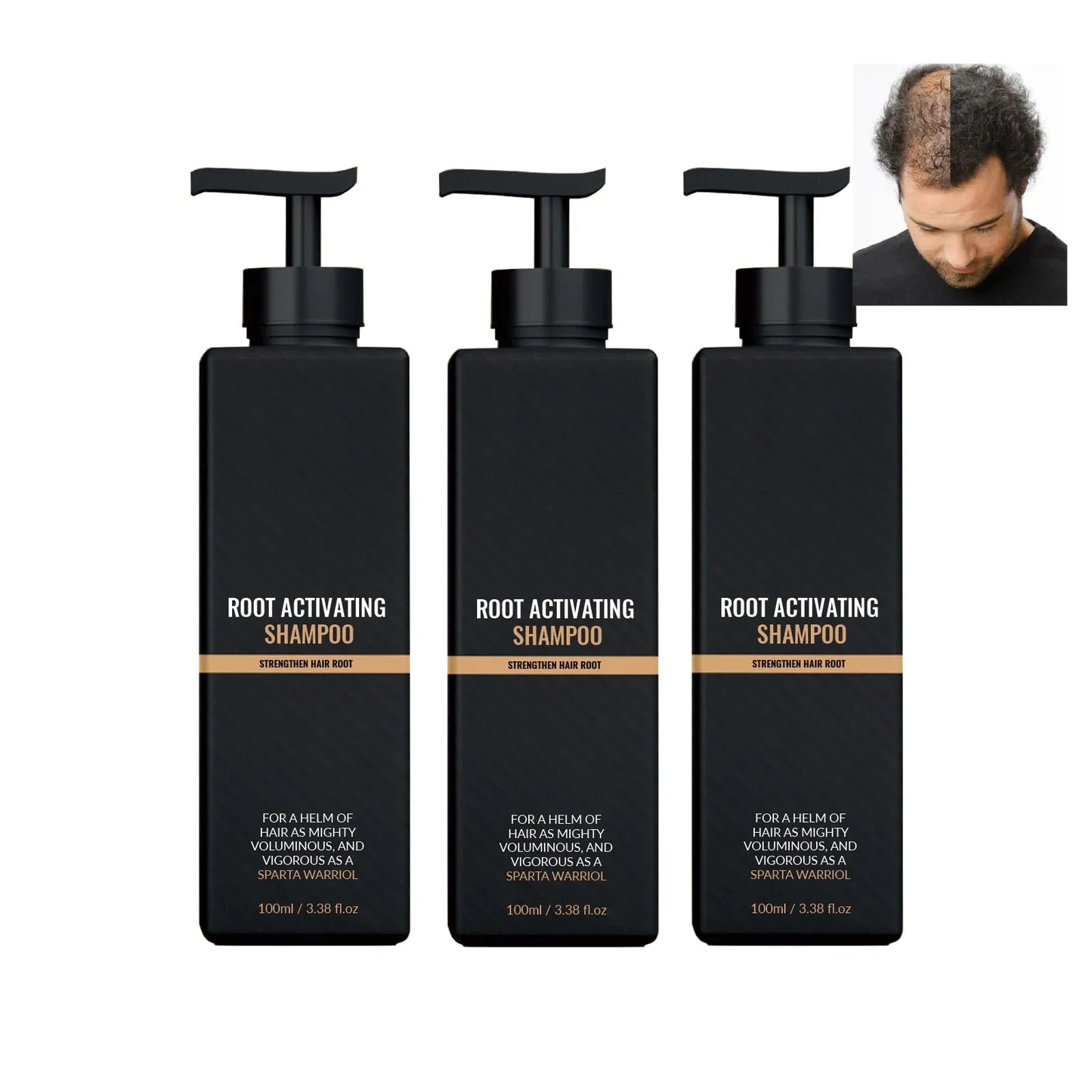 SPARTAN- Root Activator Shampoo